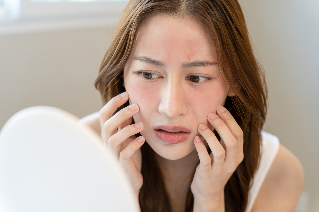 What does the word "hypoallergenic" really mean?